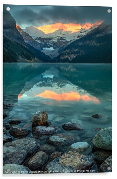 Dramatic Sunrise at Lake Louise Acrylic by Pierre Leclerc Photography