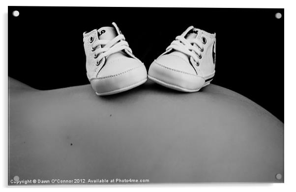 Baby Bump Acrylic by Dawn O'Connor