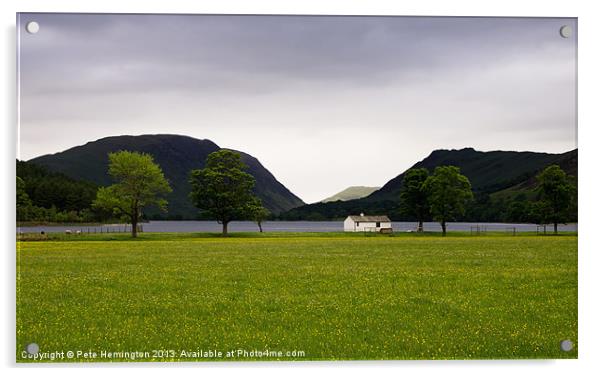 Buttercups and  Buttermere Acrylic by Pete Hemington