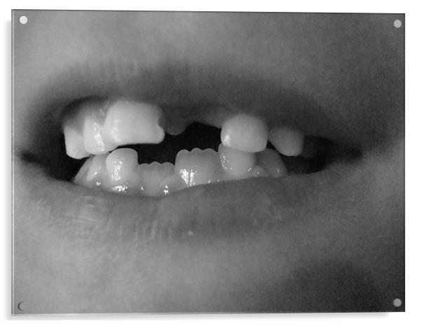 Dents d'enfant Acrylic by mazet aurelia