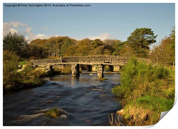  Postbridge on Dartmoor Print by Pete Hemington