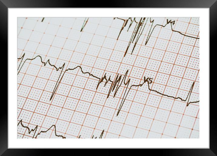 Extrasystoles On Electrocardiogram Framed Mounted Print by Radu Bercan
