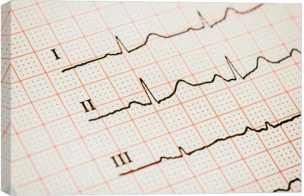 Sinus Heart Rhythm On Electrocardiogram Paper Canvas Print by Radu Bercan