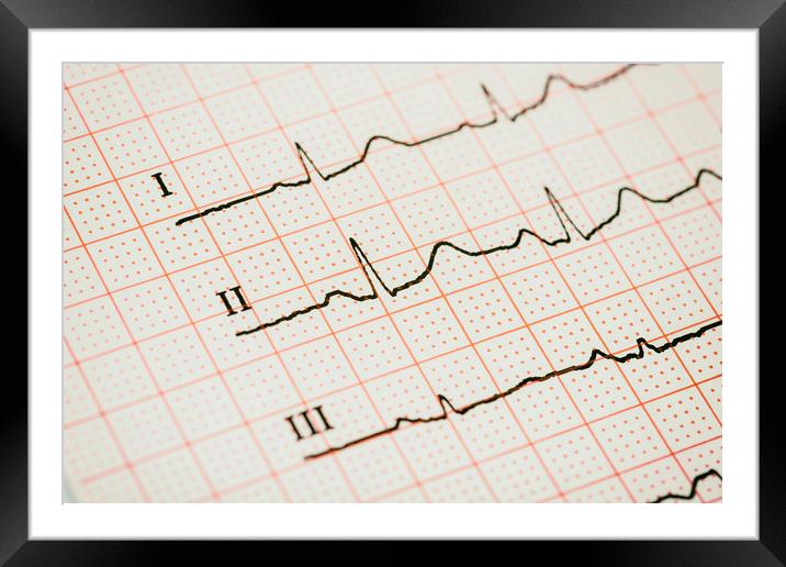 Sinus Heart Rhythm On Electrocardiogram Paper Framed Mounted Print by Radu Bercan