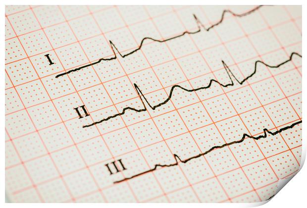 Sinus Heart Rhythm On Electrocardiogram Paper Print by Radu Bercan