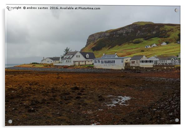 UIG VILLAGE CAFE Acrylic by andrew saxton