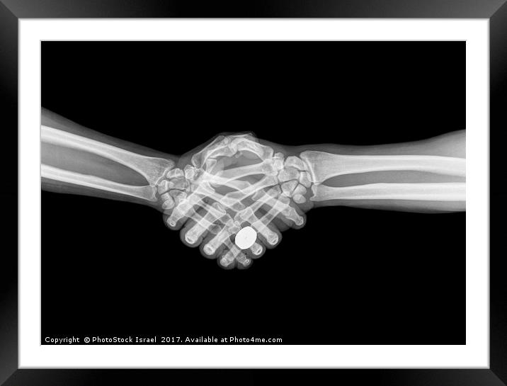 X-ray of two people shaking hands  Framed Mounted Print by PhotoStock Israel
