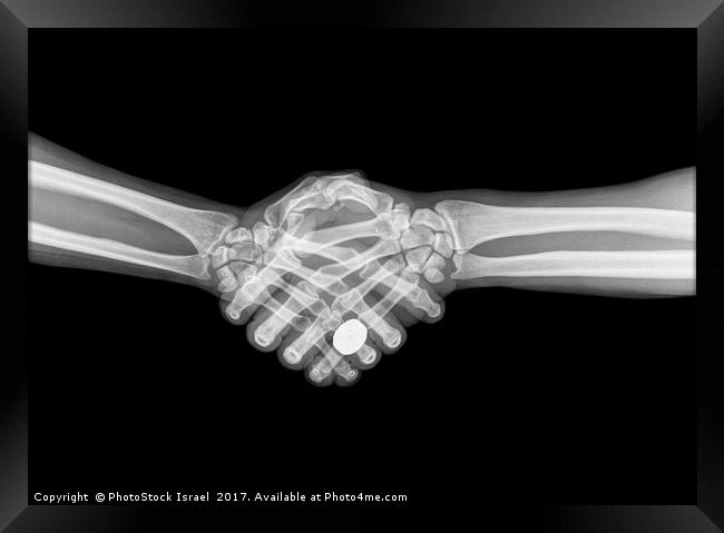 X-ray of two people shaking hands  Framed Print by PhotoStock Israel