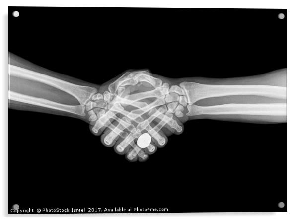 X-ray of two people shaking hands  Acrylic by PhotoStock Israel