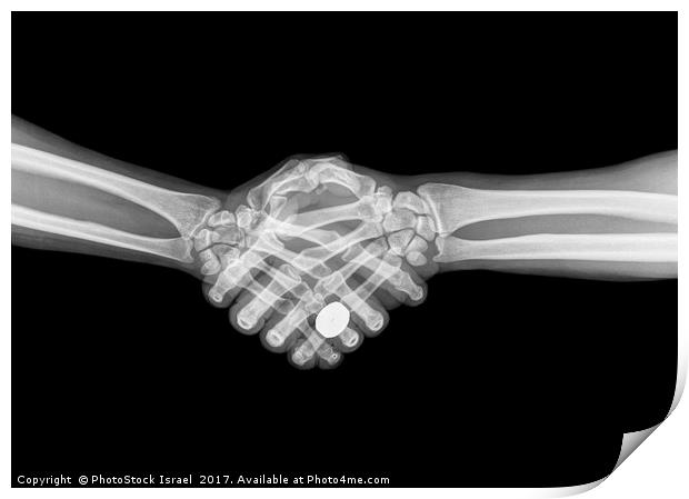 X-ray of two people shaking hands  Print by PhotoStock Israel