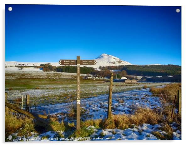 West Highland Way viewing to Glengoyne Distillery  Acrylic by yvonne & paul carroll