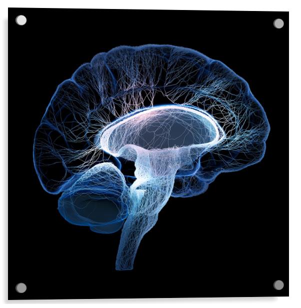 Human brain illustrated with interconnected small  Acrylic by Johan Swanepoel