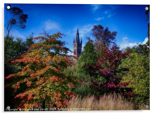 Glasgow University in autumn from Kelvingrove Park Acrylic by yvonne & paul carroll