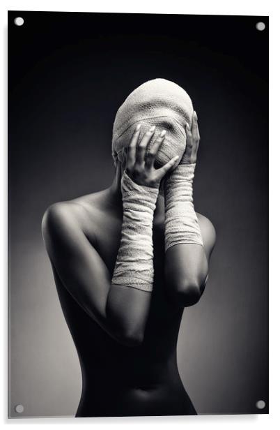 Woman in bandages Acrylic by Johan Swanepoel