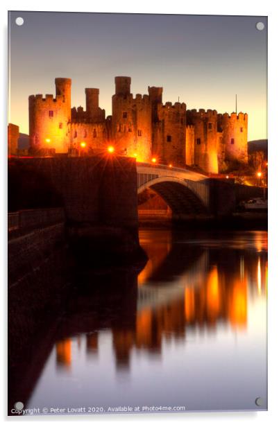 Conwy Castle Acrylic by Peter Lovatt  LRPS