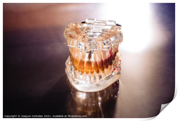 Plastic mold of a jaw with teeth, on a dentist's stainless table Print by Joaquin Corbalan