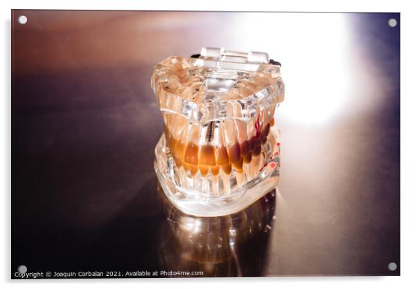 Plastic mold of a jaw with teeth, on a dentist's stainless table Acrylic by Joaquin Corbalan