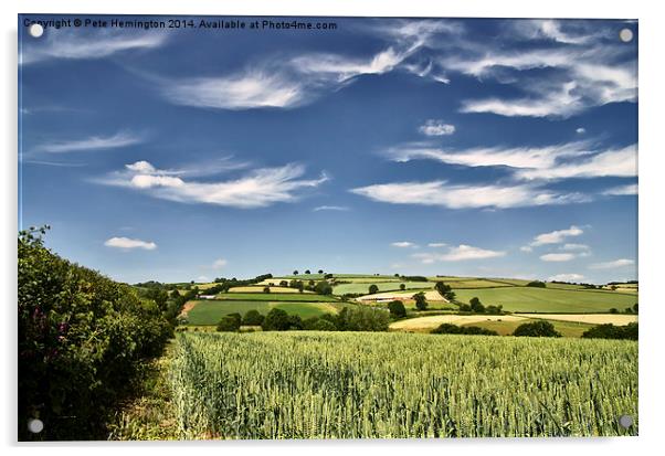 Wispy clouds over caseberry downs Acrylic by Pete Hemington