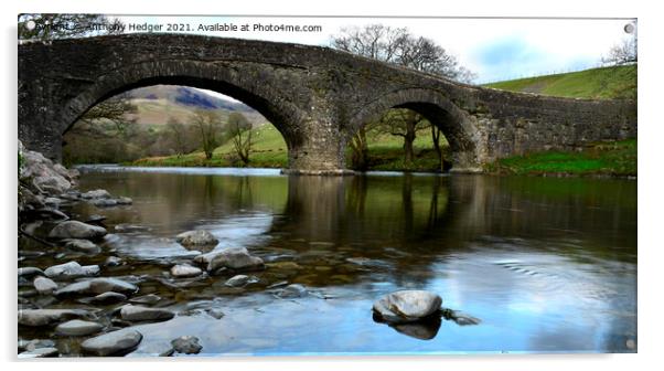 Narrow bridge Acrylic by Anthony Hedger