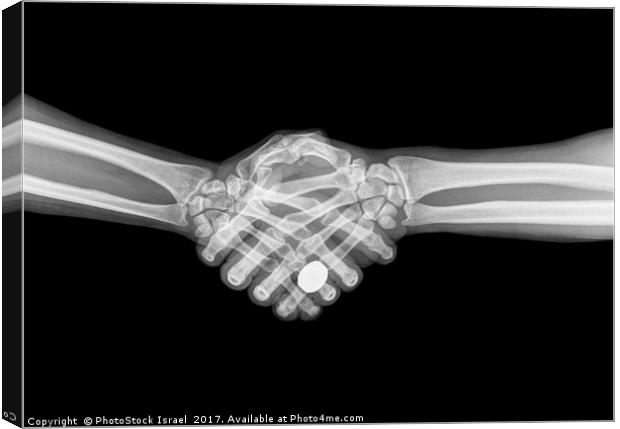 X-ray of two people shaking hands  Canvas Print by PhotoStock Israel
