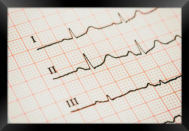 Sinus Heart Rhythm On Electrocardiogram Paper Framed Print by Radu Bercan