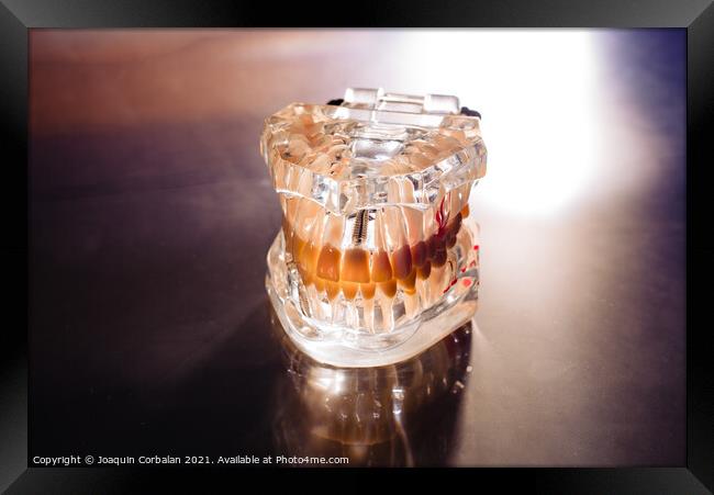 Plastic mold of a jaw with teeth, on a dentist's stainless table Framed Print by Joaquin Corbalan