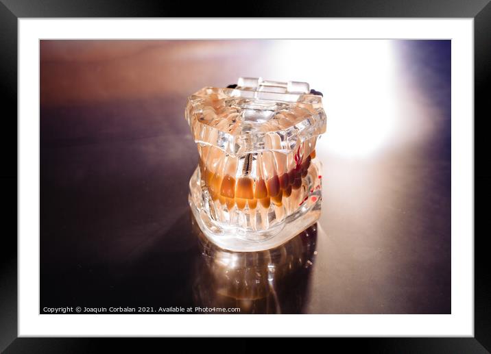 Plastic mold of a jaw with teeth, on a dentist's stainless table Framed Mounted Print by Joaquin Corbalan